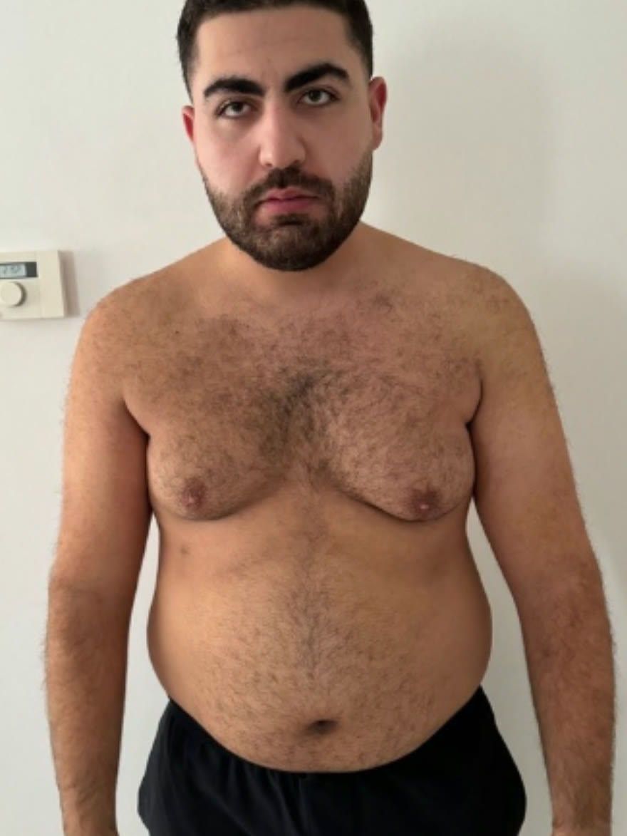 Onbewerkte foto van een cliënt met overgewicht vóór het traject